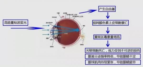 液晶电视：“原罪”蓝光如猛兽？光学防护来驱逐