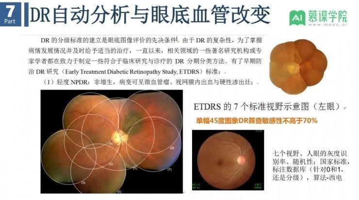 余轮教授：基于眼底影像和人工智能，怎样实现大疾病预警和个性化健康服务？