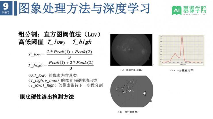 余轮教授：基于眼底影像和人工智能，怎样实现大疾病预警和个性化健康服务？