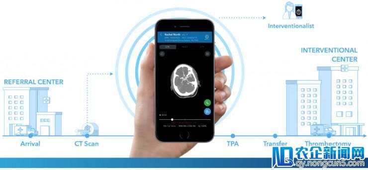 医疗 AI 获突破， FDA 批准 Viz.AI 脑卒中产品上市销售