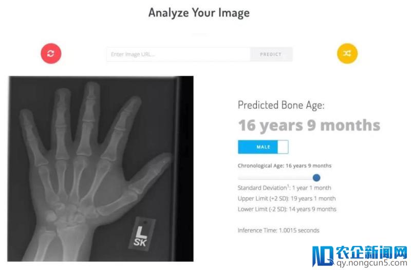 机器学习如何毫不费力测骨龄？北美放射学会机器学习挑战大赛获胜算法分享