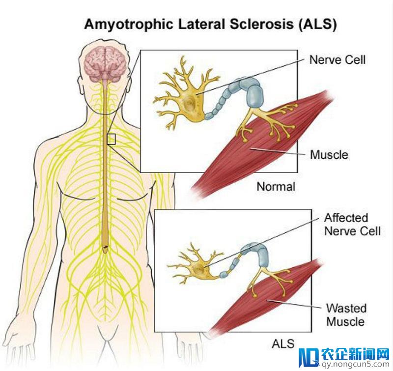 利用AI研发医疗保健、能源产品，BenevolentAI获1.15亿美元融资