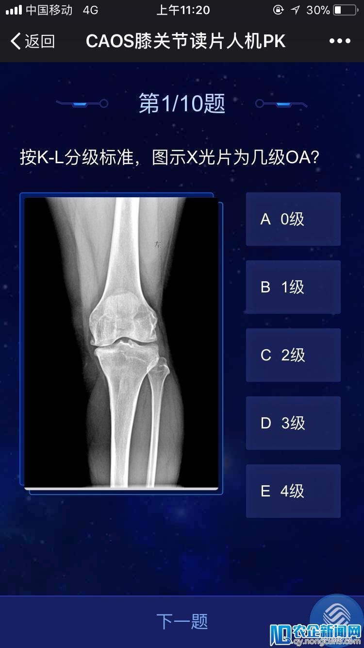 450位骨科医生迎来“人机大战”，不敌阿里云AI系统-天下网商-赋能网商，成就网商