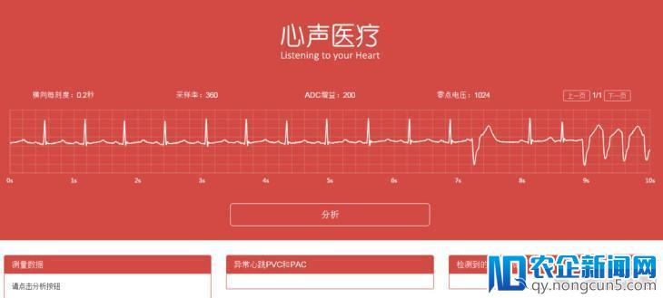 当AI遇上心电图，心声医疗帮医生自动生成诊断报告