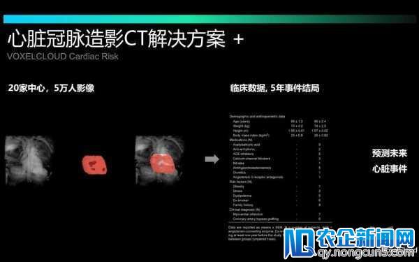 丁晓伟：成为医生左膀右臂的AI技术，如何推开传统医疗市场大门？