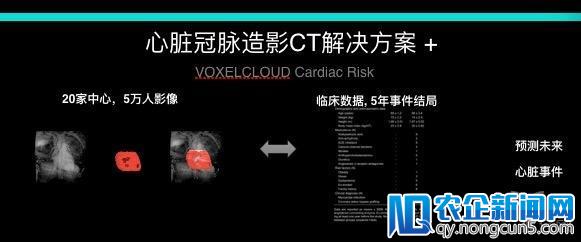 体素科技丁晓伟：医疗人工智能产品如何成为医生的“左膀右臂”？