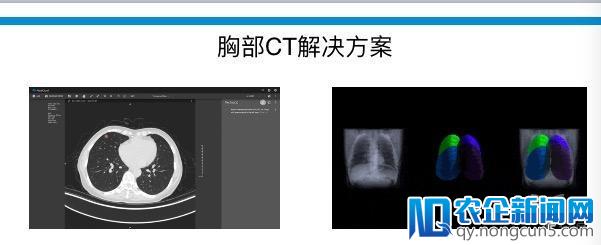 体素科技丁晓伟：医疗人工智能产品如何成为医生的“左膀右臂”？